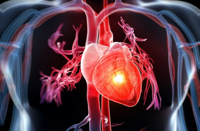 Bệnh tim mạch là các tình trạng liên quan đến sức khỏe của trái tim