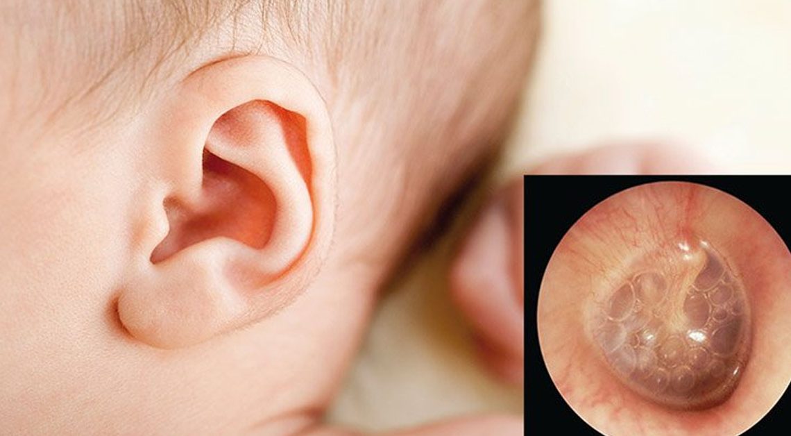 Viêm tai – một trong những bệnh lý cha mẹ cần quan tâm
